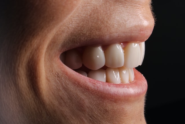 Picture of a closeup of a persons teeth while he is smiling