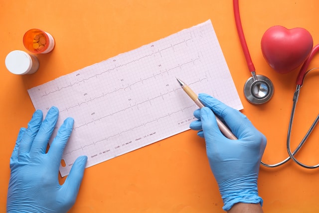 Picture of an ECG reading