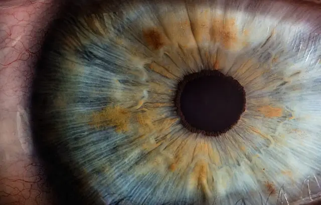 Picture of the cornea