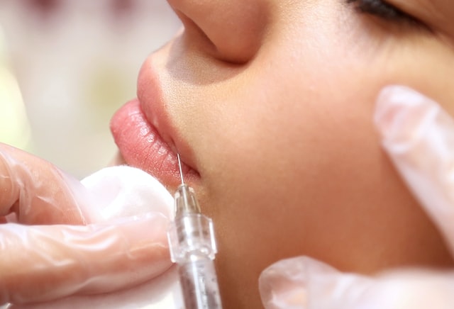 Picture of an injection being administered to the lips