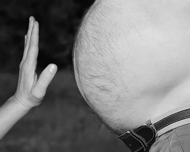 Picture of an obese persons abdomen 
