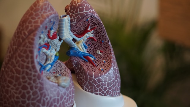 Picture of the lungs