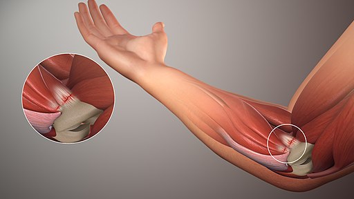 picture showing the affected area during golf elbow
